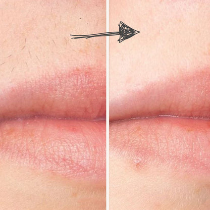 Diamond IPL Pro